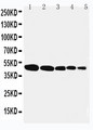 FLOT1 / Flotillin 1 Antibody - WB of FLOT1 / Flotillin 1 antibody. Lane 1: Rat Lung Tissue Lysate. Lane 2: Rat Brain Tissue Lysate. Lane 3: Rat Ovary Tissue Lysate. Lane 4: SMMC Cell Lysate. Lane 5: MFC-7 Cell Lysate..