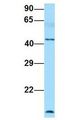 FLOT1 / Flotillin 1 Antibody - FLOT1 / Flotillin 1 antibody Western Blot of Human Fetal Lung. Antibody Dilution: 1.0 ug/ml. Antibody dilution: 1 ug/ml.  This image was taken for the unconjugated form of this product. Other forms have not been tested.