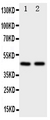 FLOT2 / Flotillin 2 Antibody - Anti-Flotillin 2 antibody, Western blotting Lane 1: Rat Lung Tissue LysateLane 2: 293T Cell Lysate