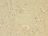 FLRT1 Antibody - Immunohistochemistry of paraffin-embedded human brain tissue using antibody at 1:100 dilution.  This image was taken for the unconjugated form of this product. Other forms have not been tested.