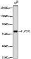 FLVCR / FLVCR1 Antibody - Western blot analysis of extracts of Raji cells using FLVCR1 Polyclonal Antibody at dilution of 1:1000.