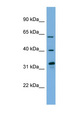 FMO3 Antibody - FMO3 antibody Western blot of OVCAR-3 cell lysate. This image was taken for the unconjugated form of this product. Other forms have not been tested.