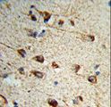 FMOD / Fibromodulin Antibody - Formalin-fixed and paraffin-embedded human brain tissue reacted with FMOD Antibody , which was peroxidase-conjugated to the secondary antibody, followed by DAB staining. This data demonstrates the use of this antibody for immunohistochemistry; clinical relevance has not been evaluated.