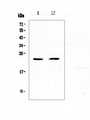 FNDC5 / Irisin Antibody - Western blot analysis of FNDC5 using anti-FNDC5 antibody. Electrophoresis was performed on a 5-20% SDS-PAGE gel at 70V (Stacking gel) / 90V (Resolving gel) for 2-3 hours. The sample well of each lane was loaded with 50ug of sample under reducing conditions. Lane 1: rat heart tissue lysates, Lane 2: mouse heart tissue lysates. After Electrophoresis, proteins were transferred to a Nitrocellulose membrane at 150mA for 50-90 minutes. Blocked the membrane with 5% Non-fat Milk/ TBS for 1.5 hour at RT. The membrane was incubated with rabbit anti-FNDC5 antigen affinity purified polyclonal antibody at 0.5 ?g/mL overnight at 4?C, then washed with TBS-0.1% Tween 3 times with 5 minutes each and probed with a goat anti-rabbit IgG-HRP secondary antibody at a dilution of 1:10000 for 1.5 hour at RT. The signal is developed using an Enhanced Chemiluminescent detection (ECL) kit with Tanon 5200 system. A specific band was detected for FNDC5 at approximately 23KD. The expected band size for FNDC5 is at 23KD.