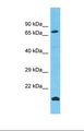 FNDC7 Antibody - Western blot of Human THP-1. FNDC7 antibody dilution 1.0 ug/ml.  This image was taken for the unconjugated form of this product. Other forms have not been tested.