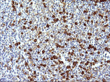 FNDC8 Antibody - IHC of paraffin-embedded Human lymph node tissue using anti-FNDC8 mouse monoclonal antibody. (Heat-induced epitope retrieval by 1 mM EDTA in 10mM Tris, pH8.5, 120°C for 3min).