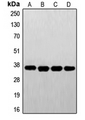 FOLR1 / Folate Receptor Alpha Antibody - Western blot analysis of FR alpha expression in A431 (A); HeLa (B); HepG2 (C); JAR (D) whole cell lysates.