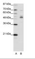 FOXA2 Antibody - A: Marker, B: HepG2 Cell Lysate.  This image was taken for the unconjugated form of this product. Other forms have not been tested.