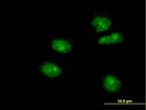 FOXA2 Antibody - Immunofluorescence of monoclonal antibody to FOXA2 on HeLa cell. [antibody concentration 10 ug/ml].