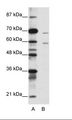 FOXA2 Antibody - A: Marker, B: Jurkat Cell Lysate.  This image was taken for the unconjugated form of this product. Other forms have not been tested.