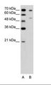 FOXB2 Antibody - A: Marker, B: Jurkat Cell Lysate.  This image was taken for the unconjugated form of this product. Other forms have not been tested.