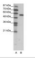 FOXC2 Antibody - A: Marker, B: Jurkat Cell Lysate.  This image was taken for the unconjugated form of this product. Other forms have not been tested.