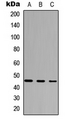 FOXD4L5 Antibody - Western blot analysis of FoxD4L5 expression in HEK293T (A); Raw264.7 (B); PC12 (C) whole cell lysates.