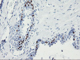 FOXI1 Antibody - IHC of paraffin-embedded Human prostate tissue using anti-FOXI1 mouse monoclonal antibody. (Heat-induced epitope retrieval by 10mM citric buffer, pH6.0, 100C for 10min).