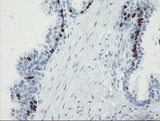 FOXI1 Antibody - IHC of paraffin-embedded Human prostate tissue using anti-FOXI1 mouse monoclonal antibody.