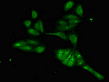 FOXI1 Antibody - Immunofluorescent analysis of Hela cells diluted at 1:100 and Alexa Fluor 488-congugated AffiniPure Goat Anti-Rabbit IgG(H+L)