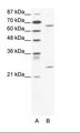 FOXK2 / ILF Antibody - A: Marker, B: Jurkat Cell Lysate.  This image was taken for the unconjugated form of this product. Other forms have not been tested.