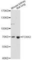 FOXK2 / ILF Antibody - Western blot analysis of extracts of various cell lines, using FOXK2 antibody at 1:1000 dilution. The secondary antibody used was an HRP Goat Anti-Rabbit IgG (H+L) at 1:10000 dilution. Lysates were loaded 25ug per lane and 3% nonfat dry milk in TBST was used for blocking. An ECL Kit was used for detection and the exposure time was 90s.