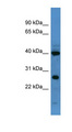 FOXL2 Antibody - FOXL2 antibody Western blot of Rat Liver lysate. This image was taken for the unconjugated form of this product. Other forms have not been tested.