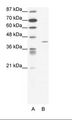 FOXL2 Antibody - A: Marker, B: Jurkat Cell Lysate.  This image was taken for the unconjugated form of this product. Other forms have not been tested.