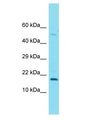 FOXL2NB Antibody - C3orf72 antibody Western Blot of PANC1. Antibody dilution: 1 ug/ml.  This image was taken for the unconjugated form of this product. Other forms have not been tested.