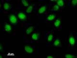 FOXM1 Antibody - Immunostaining analysis in HeLa cells. HeLa cells were fixed with 4% paraformaldehyde and permeabilized with 0.1% Triton X-100 in PBS. The cells were immunostained with anti-FOXM1 mAb.