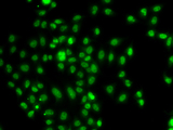 FOXN2 Antibody - Immunofluorescence analysis of A549 cells.