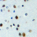 FOXN4 Antibody - Immunohistochemical analysis of FOXN4 staining in human brain formalin fixed paraffin embedded tissue section. The section was pre-treated using heat mediated antigen retrieval with sodium citrate buffer (pH 6.0). The section was then incubated with the antibody at room temperature and detected with HRP and DAB as chromogen. The section was then counterstained with hematoxylin and mounted with DPX.