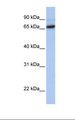 FOXO1 / FKHR Antibody - Transfected 293T cell lysate. Antibody concentration: 1.0 ug/ml. Gel concentration: 12%.  This image was taken for the unconjugated form of this product. Other forms have not been tested.