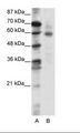 FOXO1 / FKHR Antibody - A: Marker, B: Jurkat Cell Lysate.  This image was taken for the unconjugated form of this product. Other forms have not been tested.