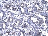 FOXP1 Antibody - FOXP1 antibody ARP32564_T100-NP_116071-FOXP1 (forkhead box P1) Antibody was used in IHC to stain formalin-fixed, paraffin-embedded human lung.  This image was taken for the unconjugated form of this product. Other forms have not been tested.