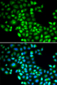 FOXP1 Antibody - Immunofluorescence analysis of U20S cells.