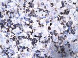 FOXP3 Antibody - FOXP3 antibody ARP32743_T100-NP_054728-FOXP3 (forkhead box P3) Antibody was used in IHC to stain formalin-fixed, paraffin-embedded human liver.  This image was taken for the unconjugated form of this product. Other forms have not been tested.