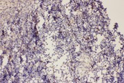 FOXP3 Antibody - FOXP3 antibody IHC-paraffin:Rat Spleen Tissue.