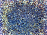FOXP3 Antibody - In paraffin embedded Mouse Spleen shows patches of stained cells in the Germinal Centre. Recommended concentration, 2-4µg/ml.
