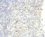 FOXP3 Antibody - IHC testing of human tonsil with FOXP3 antibody.
