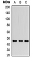 FOXP3 Antibody - Western blot analysis of FOXP3 expression in HEK293T (A); Raw264.7 (B); PC12 (C) whole cell lysates.