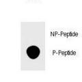 FOXP3 Antibody - Dot blot of anti-Phospho-FOXP3-S418 Phospho-specific antibody on nitrocellulose membrane. 50ng of Phospho-peptide or Non Phospho-peptide per dot were adsorbed. Antibody working concentrations are 0.5ug per ml.