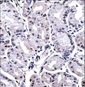 FOXP4 Antibody - FOXP4 Antibody immunohistochemistry of formalin-fixed and paraffin-embedded human stomach tissue followed by peroxidase-conjugated secondary antibody and DAB staining.