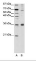 FOXQ1 Antibody - A: Marker, B: HepG2 Cell Lysate.  This image was taken for the unconjugated form of this product. Other forms have not been tested.