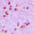 FOXR1 Antibody - Immunohistochemical analysis of FOXR1 staining in human brain formalin fixed paraffin embedded tissue section. The section was pre-treated using heat mediated antigen retrieval with sodium citrate buffer (pH 6.0). The section was then incubated with the antibody at room temperature and detected using an HRP conjugated compact polymer system. DAB was used as the chromogen. The section was then counterstained with hematoxylin and mounted with DPX.