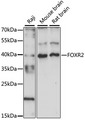 FOXR2 Antibody - Western blot analysis of extracts of various cell lines, using FOXR2 antibody at 1:1000 dilution. The secondary antibody used was an HRP Goat Anti-Rabbit IgG (H+L) at 1:10000 dilution. Lysates were loaded 25ug per lane and 3% nonfat dry milk in TBST was used for blocking. An ECL Kit was used for detection and the exposure time was 90s.