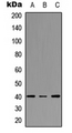 FPR3 / FPRL2 Antibody - Western blot analysis of FPR3 expression in A549 (A); NS-1 (B); PC12 (C) whole cell lysates.