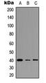 FPR3 / FPRL2 Antibody - Western blot analysis of FPR3 expression in HEK293T (A); A549 (B); PC12 (C) whole cell lysates.