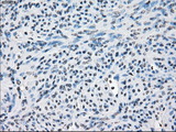 FRA-1 / FOSL1 Antibody - IHC of paraffin-embedded endometrium tissue using anti-FOSL1 mouse monoclonal antibody. (Dilution 1:50).