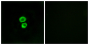 Fragilis / IFITM3 Antibody - Immunofluorescence analysis of MCF7 cells, using IFM3 Antibody. The picture on the right is blocked with the synthesized peptide.
