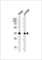 FRG1 Antibody - Western blot of lysates from HeLa, Jurkat cell line (from left to right), using FRG1 Antibody. Antibody was diluted at 1:1000 at each lane. A goat anti-rabbit IgG H&L (HRP) at 1:5000 dilution was used as the secondary antibody. Lysates at 35ug per lane.