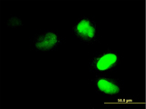 FRG1 Antibody - Immunofluorescence of monoclonal antibody to FRG1 on HeLa cell. [antibody concentration 35 ug/ml]