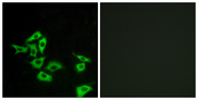 Frizzled 5+8 Antibody - Immunofluorescence analysis of A549 cells, using FZD8 Antibody. The picture on the right is blocked with the synthesized peptide.