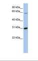 FRK Antibody - 721_B cell lysate. Antibody concentration: 1.0 ug/ml. Gel concentration: 12%.  This image was taken for the unconjugated form of this product. Other forms have not been tested.